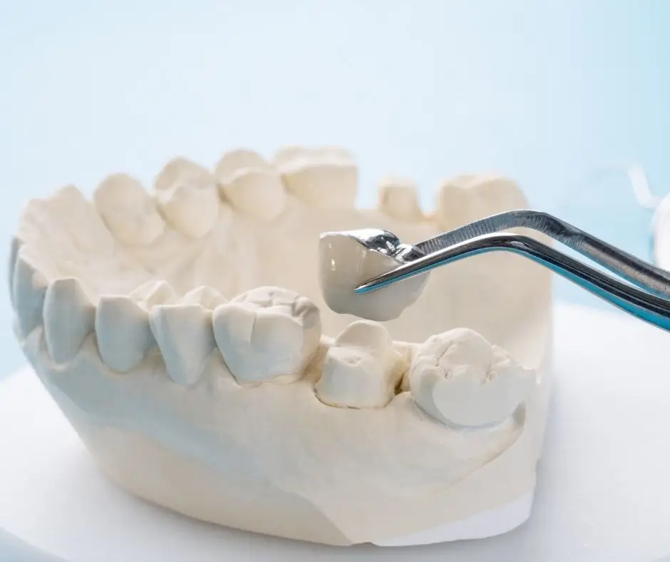 dental crown model